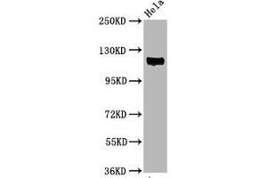 Western Blot Positive WB detected in Hela whole cell lysate All lanes Phospho-PTK2 antibody at 3. (Rekombinanter FAK Antikörper  (pTyr397))