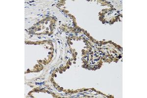 Immunohistochemistry of paraffin-embedded human prostate using IL25 antibody at dilution of 1:100 (40x lens).