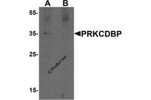 Western Blotting (WB) image for anti-Protein Kinase C, delta Binding Protein (PRKCDBP) antibody (ABIN1077454) (PRKCDBP Antikörper)