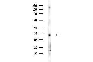 Western blot analysis of lysates from F10-LUC cells(heat-shock,45 min treatment), using PCYA Antibody at 1/1000 dilution.