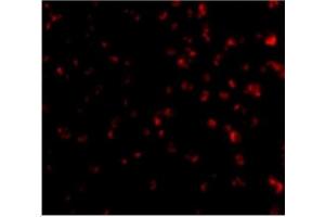 Immunofluorescence of TIM-4 in Jurkat cells with TIM-4 antibody at 20 µg/ml.