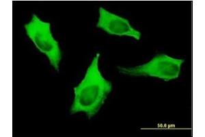 Immunofluorescence (IF) image for anti-Myosin 9 (MYH9) (AA 131-221) antibody (ABIN781937) (Myosin 9 Antikörper  (AA 131-221))