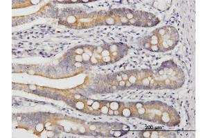 Immunoperoxidase of monoclonal antibody to LIAS on formalin-fixed paraffin-embedded human small Intestine. (LIAS Antikörper  (AA 273-372))