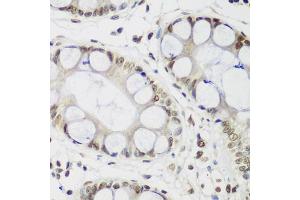 Immunohistochemistry of paraffin-embedded human gastric using CBX3 antibody. (CBX3 Antikörper)