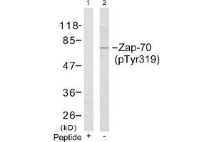 Western blot analysis of extracts from Jurkat cells using Zap-70(Phospho-Tyr319) Antibody(Lane 2) and the same antibody preincubated with blocking peptide(Lane1). (ZAP7 (pTyr319) Antikörper)