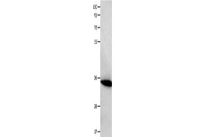 Gel: 10+12 % SDS-PAGE, Lysate: 40 μg, Lane: Mouse heart tissue, Primary antibody: ABIN7129537(FOXS1 Antibody) at dilution 1/200, Secondary antibody: Goat anti rabbit IgG at 1/8000 dilution, Exposure time: 10 seconds (FOXS1 Antikörper)