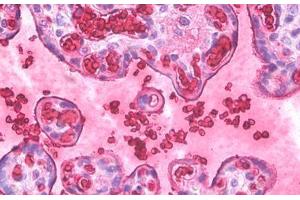 Anti-Hemoglobin antibody IHC staining of human placenta, erythrocytes. (Hemoglobin Antikörper)