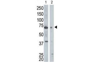 Western Blotting (WB) image for anti-Golgi-Associated, gamma Adaptin Ear Containing, ARF Binding Protein 1 (GGA1) antibody (ABIN3001508) (GGA1 Antikörper)