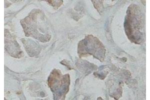 Immunohistochemical staining of formalin-fixed paraffin-embedded human pancreas tissue showing cytoplasmic staining with CARD6 polyclonal antibody  at 1 : 100 dilution. (CARD6 Antikörper  (C-Term))