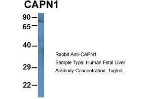 Host: Rabbit  Target Name: CAPN1  Sample Tissue: Human Fetal Liver  Antibody Dilution: 1. (CAPNL1 Antikörper  (N-Term))