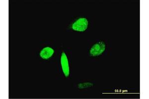 Immunofluorescence of monoclonal antibody to FOXA2 on HeLa cell. (FOXA2 Antikörper  (AA 363-457))