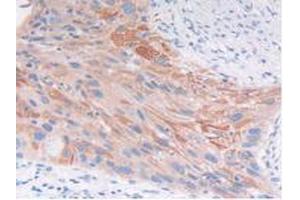 IHC-P analysis of Human Lung Tissue, with DAB staining. (FGFRL1 Antikörper  (AA 168-378))