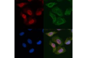 WEE1 Mouse Monoclonal Antibody staining Hela cells by IF/ICC. (WEE1 Antikörper)