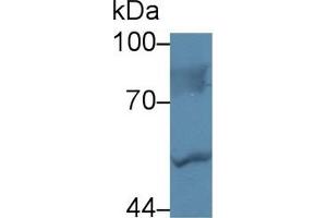 Detection of LBP in Human Hela cell lysate using Polyclonal Antibody to Lipopolysaccharide Binding Protein (LBP) (LBP Antikörper  (AA 224-468))