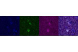 Immunohistochemistry (IHC) image for anti-Oligodendrocyte Lineage Transcription Factor 2 (OLIG2) antibody (ABIN7456250) (OLIG2 Antikörper)