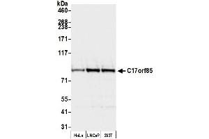 anti-Chromosome 17 Open Reading Frame 85 (C17ORF85) (AA 25-75) antibody