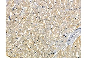 ABIN7095165 and ABIN7099221 at 1/100 staining rat heart tissue by IHC-P. (SLC38A4 Antikörper)