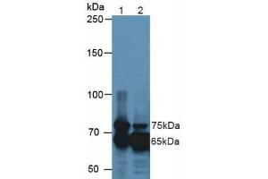 Western blot analysis of (1) Mouse Kidney Tissue and (2) Mouse Eye Tissue. (TGFBI Antikörper  (AA 423-632))