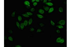 Immunofluorescent analysis of A549 cells using ABIN7143701 at dilution of 1:100 and Alexa Fluor 488-congugated AffiniPure Goat Anti-Rabbit IgG(H+L) (AKR1B1 Antikörper  (AA 114-230))