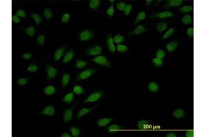 Immunofluorescence of monoclonal antibody to NR3C1 on HeLa cell. (Glucocorticoid Receptor Antikörper  (AA 51-140))