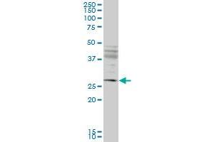 Western Blotting (WB) image for anti-Intraflagellar Transport 57 Homolog (IFT57) (AA 214-313) antibody (ABIN961309)