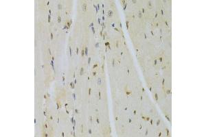 Immunohistochemistry of paraffin-embedded mouse heart using HMGB1 Antibody. (HMGB1 Antikörper  (AA 100-200))