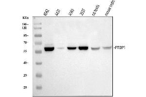 Western blot analysis of PTBP1 using anti-PTBP1 antibody (ABIN7599451). (PTBP1 Antikörper  (AA 1-504))