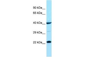 Host: Rabbit Target Name: ASCL1 Sample Type: COLO205 Whole cell lysates Antibody Dilution: 1.