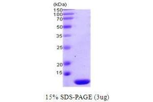 Figure annotation denotes ug of protein loaded and % gel used. (Thioredoxin 2 (TXN2) (AA 60-166) Peptid)