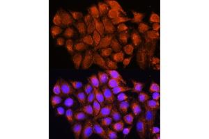 Immunofluorescence analysis of HeLa cells using D antibody (ABIN6129731, ABIN6137329, ABIN6137330 and ABIN6225254) at dilution of 1:100.