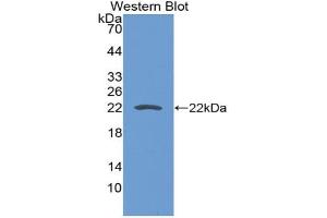Western blot analysis of the recombinant protein. (CD276 Antikörper  (AA 47-213))