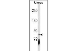 Western blot analysis in Uterus tissue lysates (35ug/lane). (PCDHGB4 Antikörper  (AA 353-379))