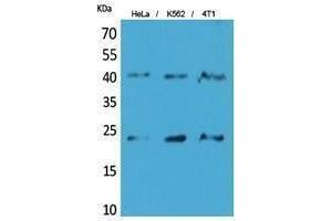 Western Blotting (WB) image for anti-Transmembrane Protein 173 (TMEM173) (C-Term) antibody (ABIN3178504) (STING/TMEM173 Antikörper  (C-Term))
