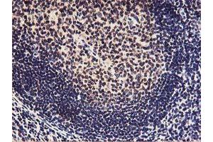 Immunohistochemical staining of paraffin-embedded Human tonsil using anti-HOXC11 mouse monoclonal antibody.