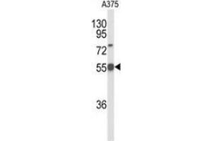 Western blot analysis of DLL3 (arrow) in A375 cell line lysates (35ug/lane) using DLL3 