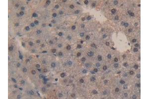 Immunohistochemistry (IHC) image for anti-Caspase 3 (CASP3) (AA 29-175) antibody (ABIN7442660)