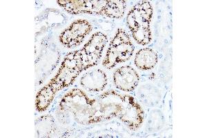 Immunohistochemistry (IHC) image for anti-Low Density Lipoprotein Receptor (LDLR) (C-Term) antibody (ABIN7268296)