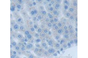 Immunohistochemistry (IHC) image for anti-Catechol-O-Methyltransferase (COMT) (AA 63-264) antibody (ABIN1858470)