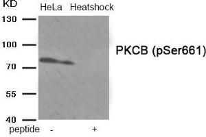 Western blot analysis of extracts from HeLa cells treated with Heatshock using Phospho-PKCB (Ser661) antibody.