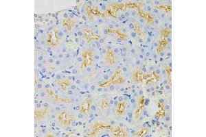 Immunohistochemistry of paraffin-embedded rat kidney using SYK Antibody (ABIN5971150) at dilution of 1/100 (40x lens). (SYK Antikörper)