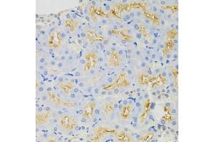 Immunohistochemistry of paraffin-embedded rat kidney using SYK Antibody (ABIN5971150) at dilution of 1/100 (40x lens).
