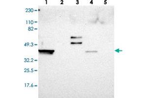 Western blot analysis of Lane 1: RT-4, Lane 2: U-251 MG, Lane 3: Human Plasma, Lane 4: Liver, Lane 5: Tonsil with ERICH1 polyclonal antibody  at 1:250-1:500 dilution. (ERICH1 Antikörper)