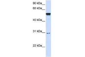 WB Suggested Anti-AIRE Antibody Titration:  0. (AIRE Antikörper  (Middle Region))
