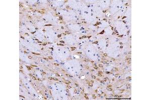 IHC analysis of SRGAP3 using anti-SRGAP3 antibody (ABIN7602538). (SRGAP3 Antikörper  (AA 824-1067))