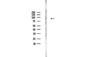 Western blot analysis of lysates from COLO205 cells(heat-shock,45 min treatment), using BRAT1 Antibody at 1/1000 dilution.