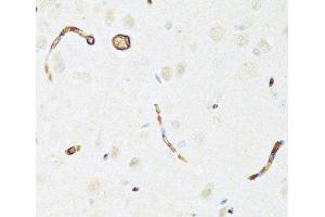 Immunohistochemistry of paraffin-embedded Rat brain using P Glycoprotein Polyclonal Antibody at dilution of 1:100 (40x lens). (P-Glycoprotein Antikörper)