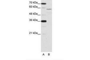 Image no. 1 for anti-Neuro-Oncological Ventral Antigen 2 (NOVA2) (AA 185-234) antibody (ABIN202652) (NOVA2 Antikörper  (AA 185-234))
