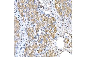 Immunohistochemistry (IHC) image for anti-Eukaryotic Translation Initiation Factor 2 alpha Kinase 4 (EIF2AK4) (AA 1-300) antibody (ABIN6140031)
