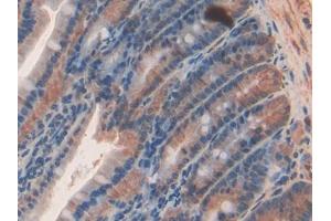 DAB staining on IHC-P; Samples: Rat Intestine Tissue (SEMA3A Antikörper  (AA 31-150))