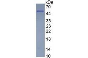 SDS-PAGE analysis of Human Vimentin Protein. (Vimentin Protein (VIM))